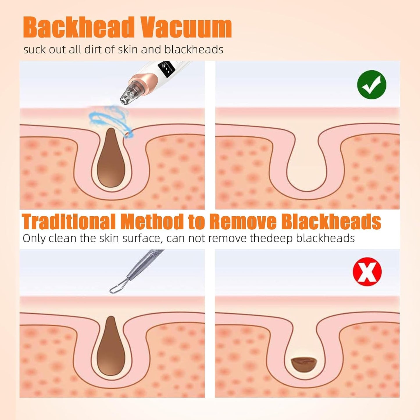 2025 Pore Vacuum, USB Rechargeable Blackhead Remover Vacuum,3 Levels Adjustable Pore Vacuum Blackhead Remover, with 5 Suction Power,6 Probes,Face Vacuum Pore Cleanser for Women & Men-White