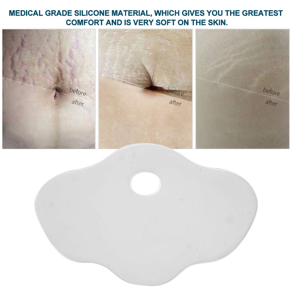 Beauty Stickers,Reusable Silicone AntiWrinkle Belly Stomach Pads Stickers Stretch Marks Removal For Skin Care