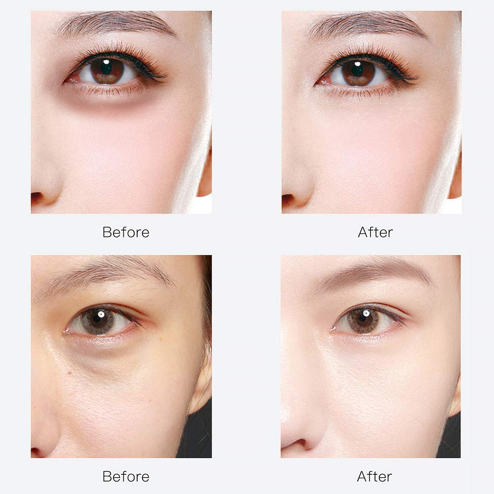 Under Eye Patches,30 pairs Hyaluronic Acid Anti-Aging Under Eye Mask, Collagen Under Eye Gel Pads for Dark Circles, Wrinkles, Fine Line, Puffiness (Blue)