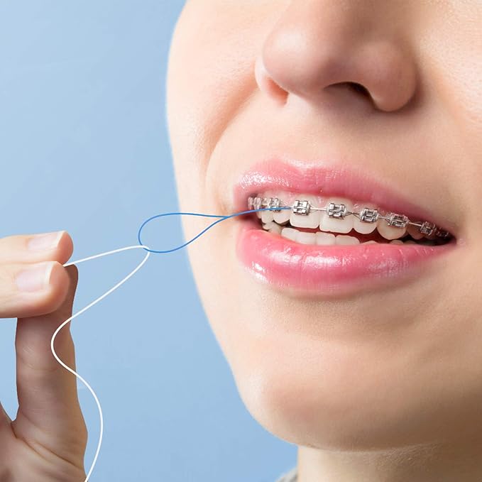 400 Count Floss Threaders for Braces, Bridges, and Implants (8 Packs of 50) - Flexible Nylon Threading Loops - Slim & Durable Dental Floss Helpers for Crowns & Orthodontic Appliances