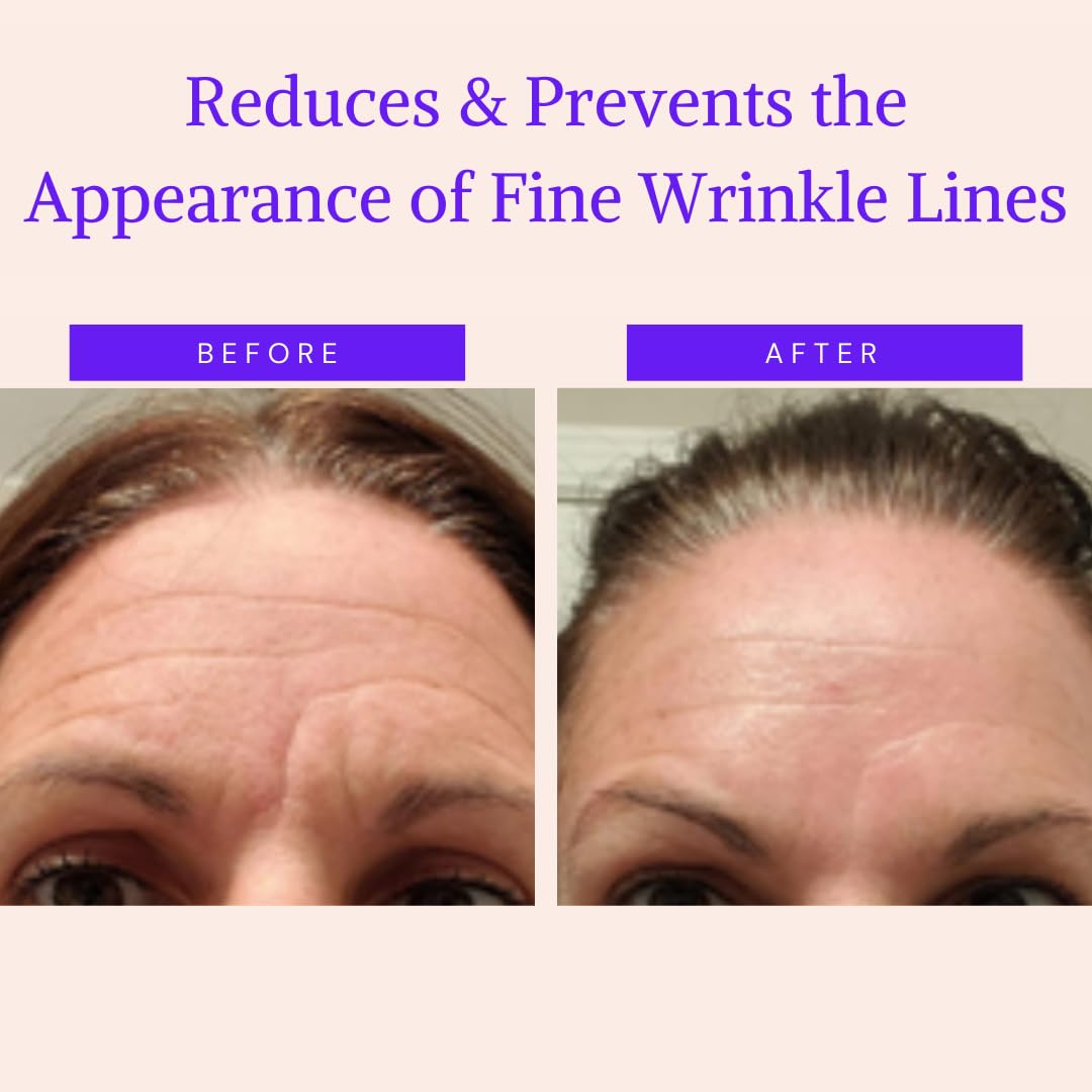 BLUMBODY Face & Forehead Wrinkle Patches - Anti Wrinkle Facial Patches to Smooth Eye, Mouth, Forehead Wrinkles - Non-Silicone Face Tape for Fine Wrinkles between Eyes & Face - Patches (30 day supply)