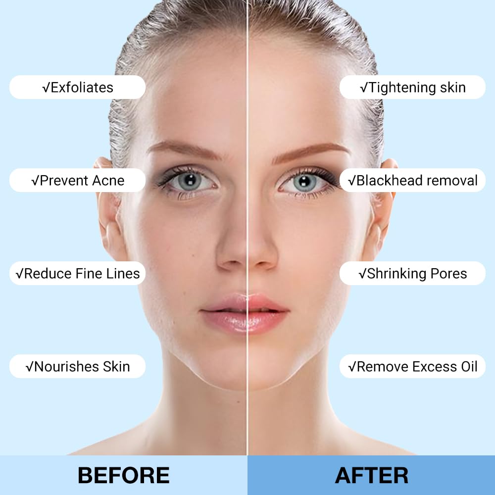 Clay Mask For Face Skincare, Blackhead Remover Face Mask with Blueberry Extract, Deep Pore Cleansing, Moisturizing, Skincare Facial Mask for Refining Pores and Controlling Oil, 40g/1.35oz