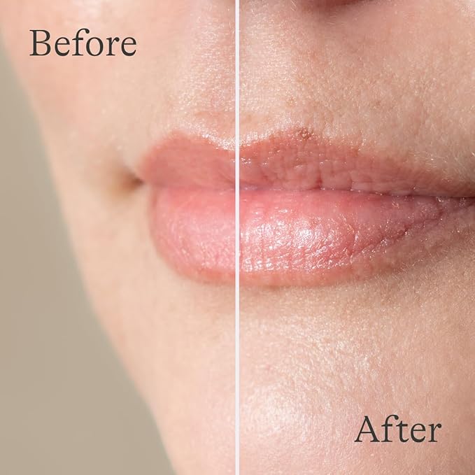 Lansinoh Lanolin Lip Balm, 2 Pack, 0.25 oz Each, Ultra-Moisturizing Lip Care with Natural Lanolin for Dry, Chapped Lips