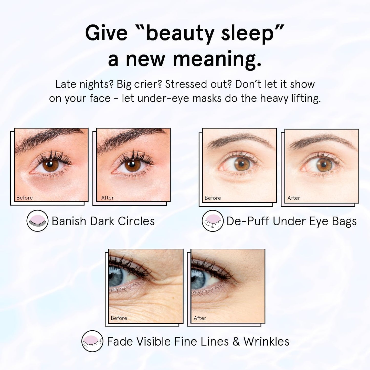 grace & stella Retinol Under Eye Patches for Puffy Eyes and Dark Circles - Restoring Gel Under Eye Masks with Hyaluronic Acid - Vegan Cruelty-Free Skincare - Birthday Gifts for Women (Purple, 6 Pairs)