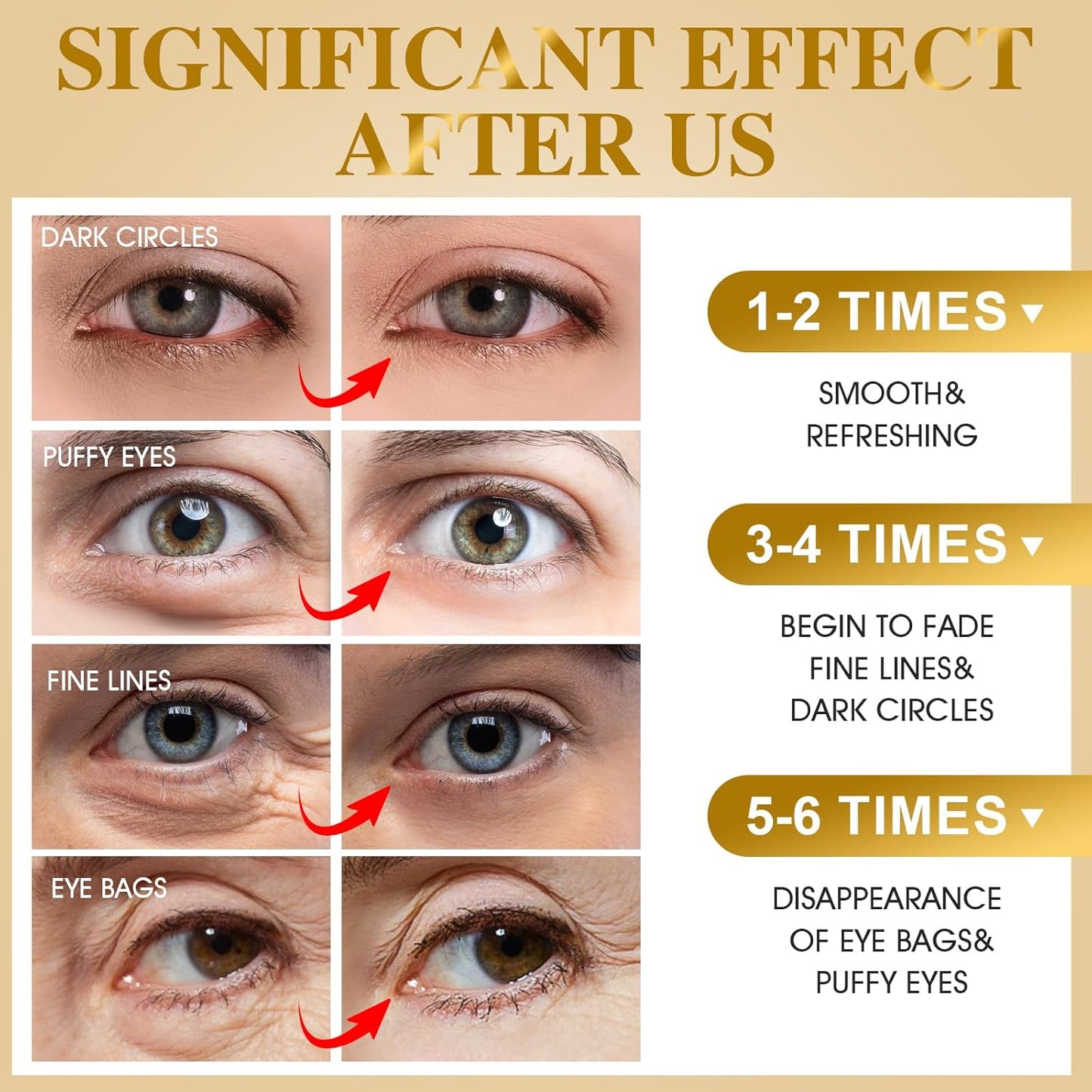 120 PCS 24K Gold Under Eye Patches for Dark Circles and Puffy Eyes, Eye Mask With Collagen and Hyaluronic Acid for Dark Circles, Puffiness and Wrinkles, Eye Skin Care for Women