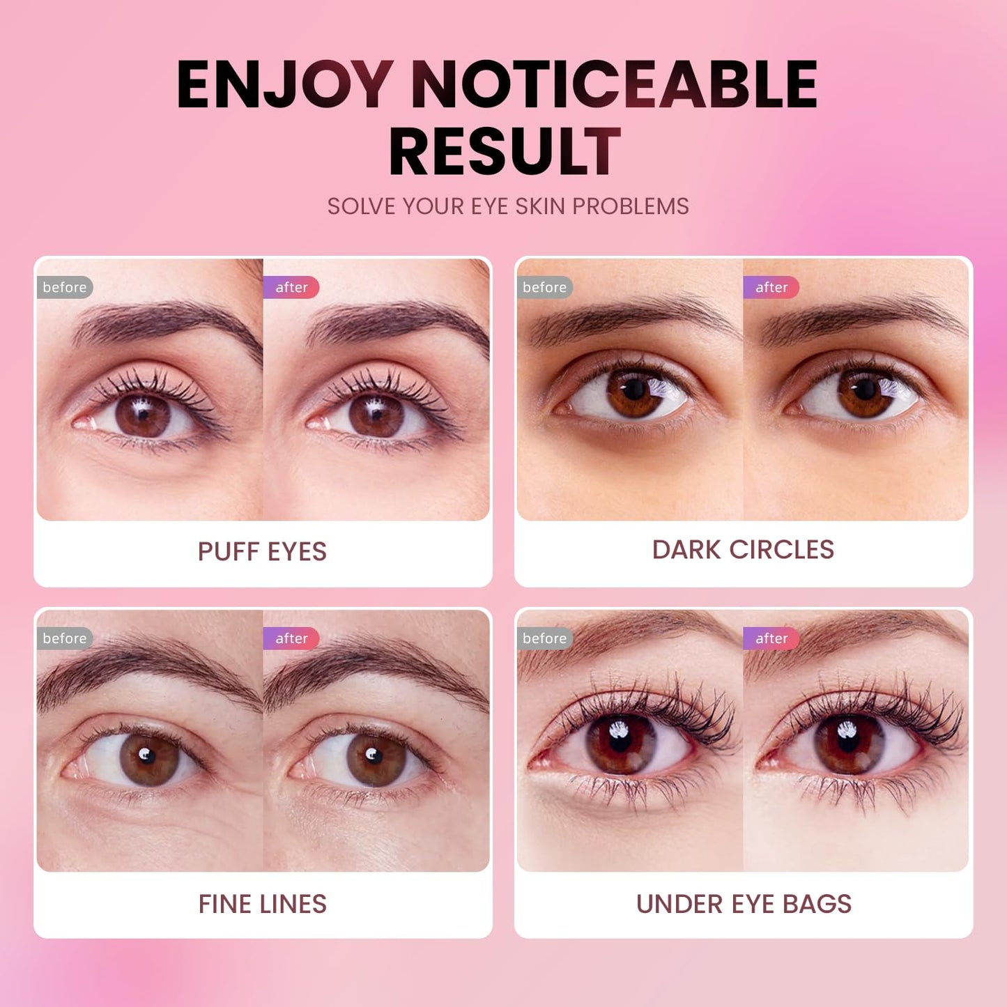 Under Eye Patches (20 Pairs)-New Tri-color Glitter Eye Gel Pads for Dark Circles Puffy Eyes,Under eye Bags,Wrinkles|Natural Collagen Under Eye Mask Patches for Women Teen