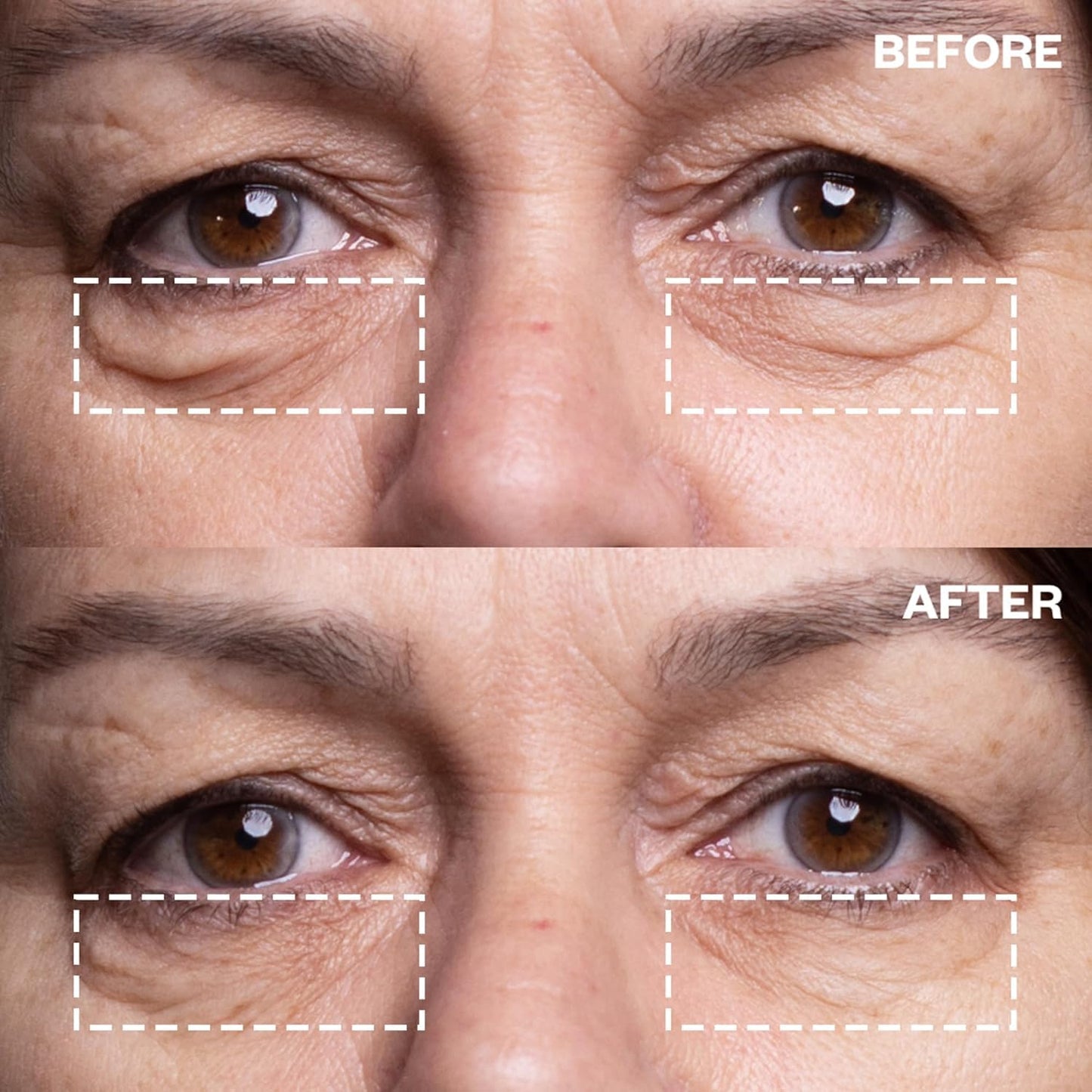 Wrinkles Schminkles Under Eye Patches - Rejuvenate Wrinkles with Medical Grade Silicone Reusable Anti-Wrinkle Patches for Under Eye Treatment, Banish Dark Circles (3 Pairs)