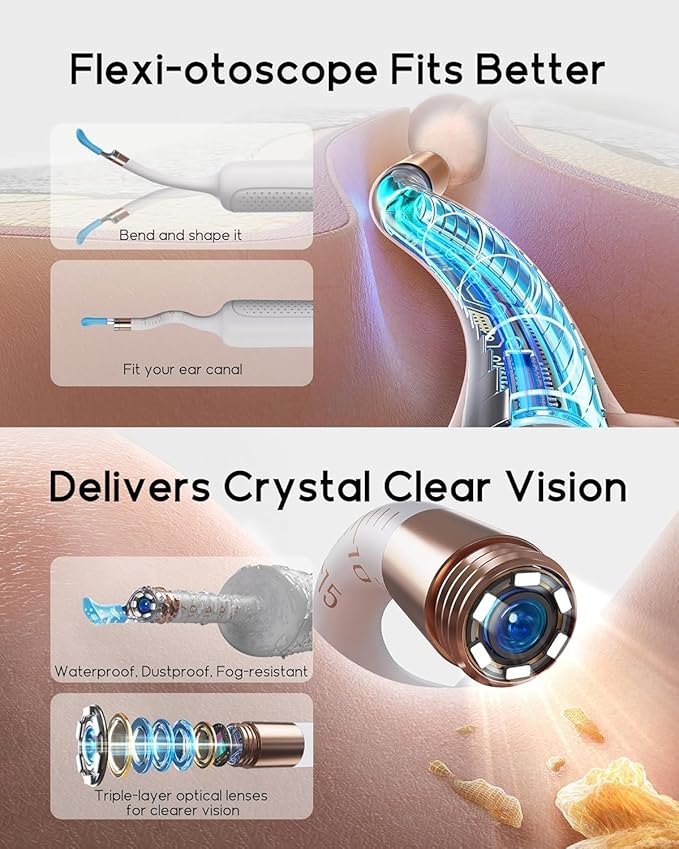 Bebird Earsight Plus R37R Ear Cleaning Camera Wax Removal Tool kit, FSA HSA Eligible Flexible Ear Scope Otoscope Camera Light, Visual Ear Picker Wireless Earwax Remover Tweezers for Adults & Kids
