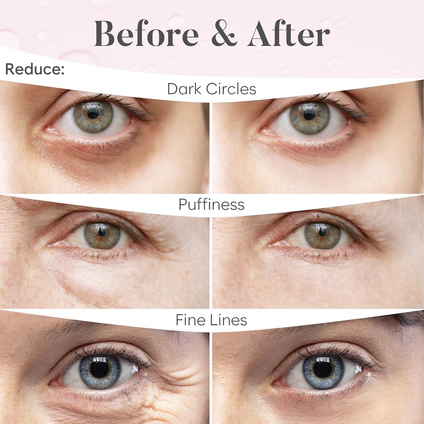Rose Eye Mask (30 Pairs) | Eye Masks with Niacinamide & Hyaluronic Acid | Under Eye Patches for Dark Circles | Under Eye Patches for Puffy Eyes | Eye Care