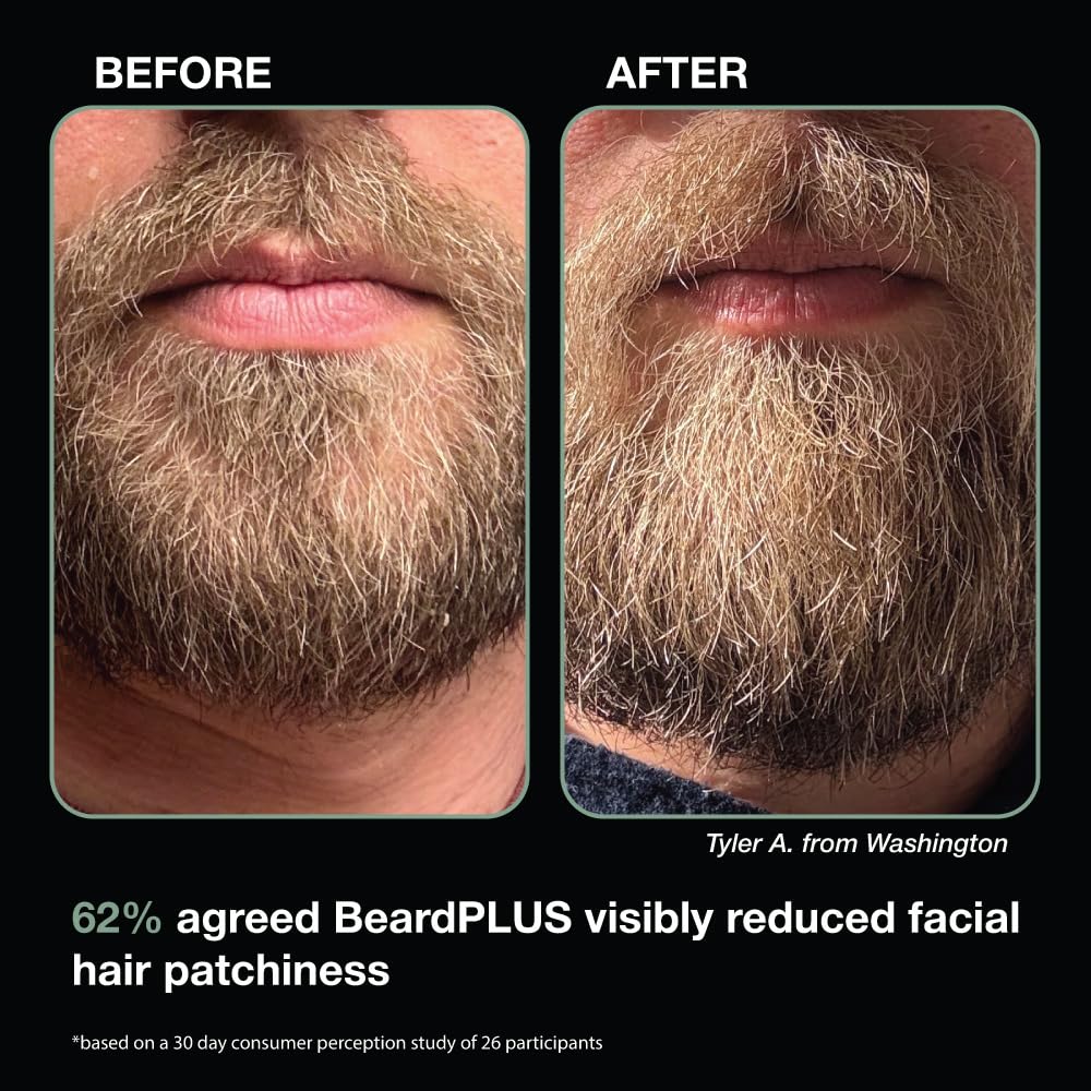ZEUS BeardPlus Growth Serum for Men, Refined Beard Oil with Biotin, Caffeine & Collagen for Thicker, Fuller, Softer Facial Hair & Healthy Skin Care (Made in USA) 1.6 oz