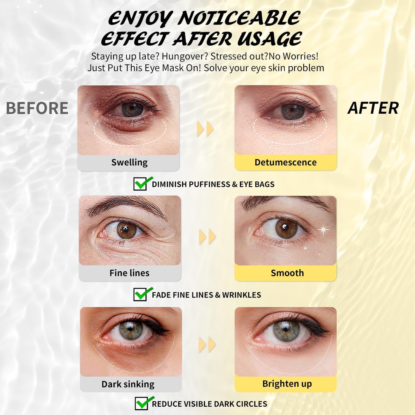 Under Eye Patches(30 Pairs), 24K Gold, Caffeine, Hyaluronic Acid, Aloe Vera Eye Masks for Dark Circles Puffy Eyes Undereye Bags, Eye Skin Care Gift Set for Bachelorette Party Favors