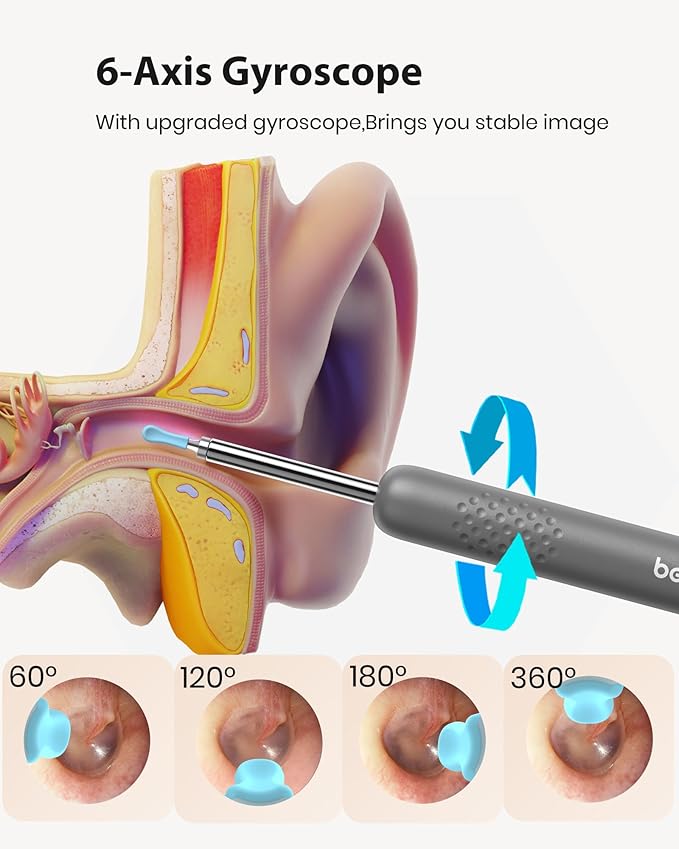 BEBIRD R1 Wax Removal Tool for Ear - Spade Ear Canal Cleaner with Camera 1080P Earscope, Wax Remove Ear Picker with Vari Replacement Tips, Camera with 6LED Light for Ear/Nose/Throat Examination, Blue