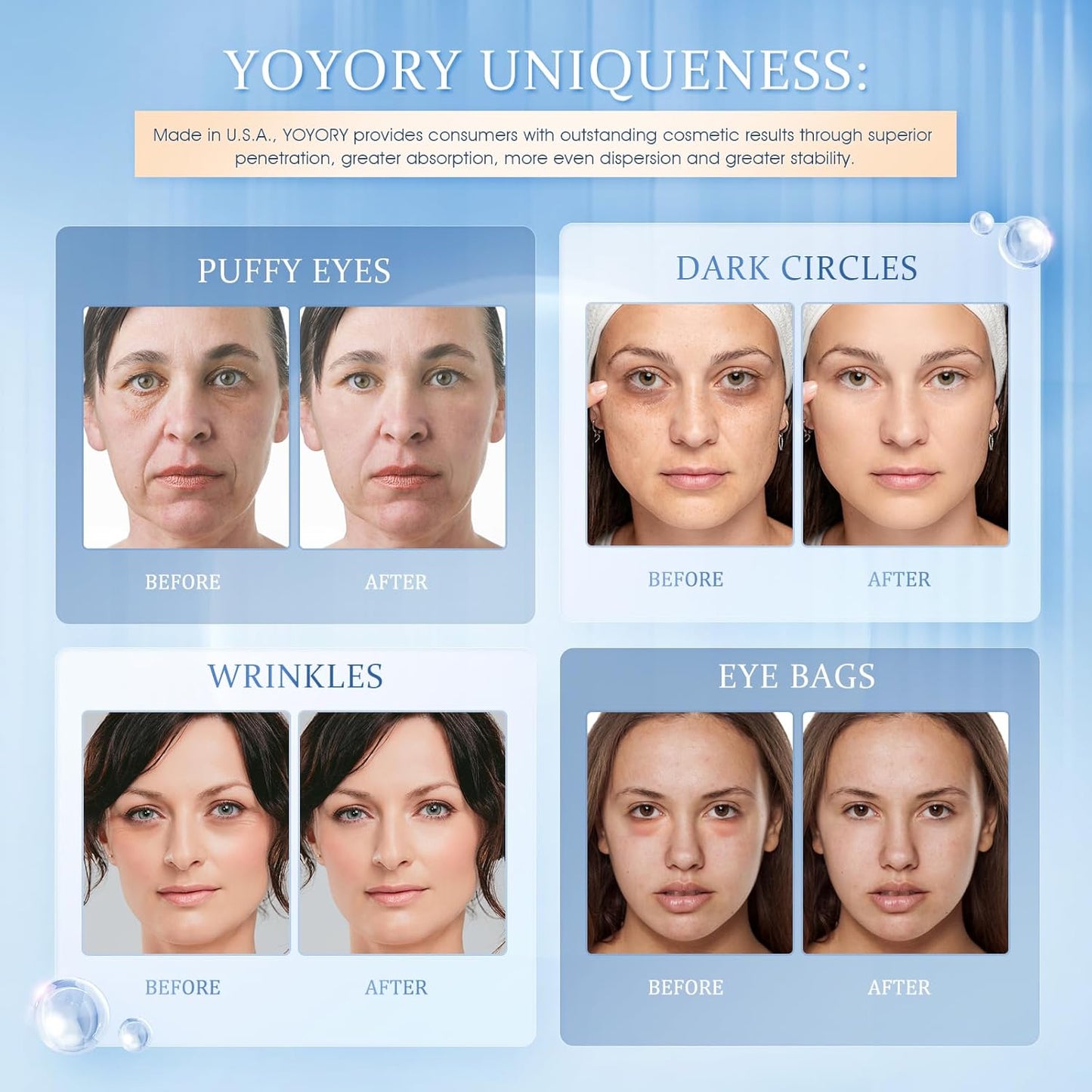 Under Eye Patches Masks - for Dark Circles, Puffy Eyes, Fine Lines, Wrinkles, Eye Bags Treatment with Collagen and Hyaluronic Acid, Moisturizing and Hydrating (60 Pcs)…