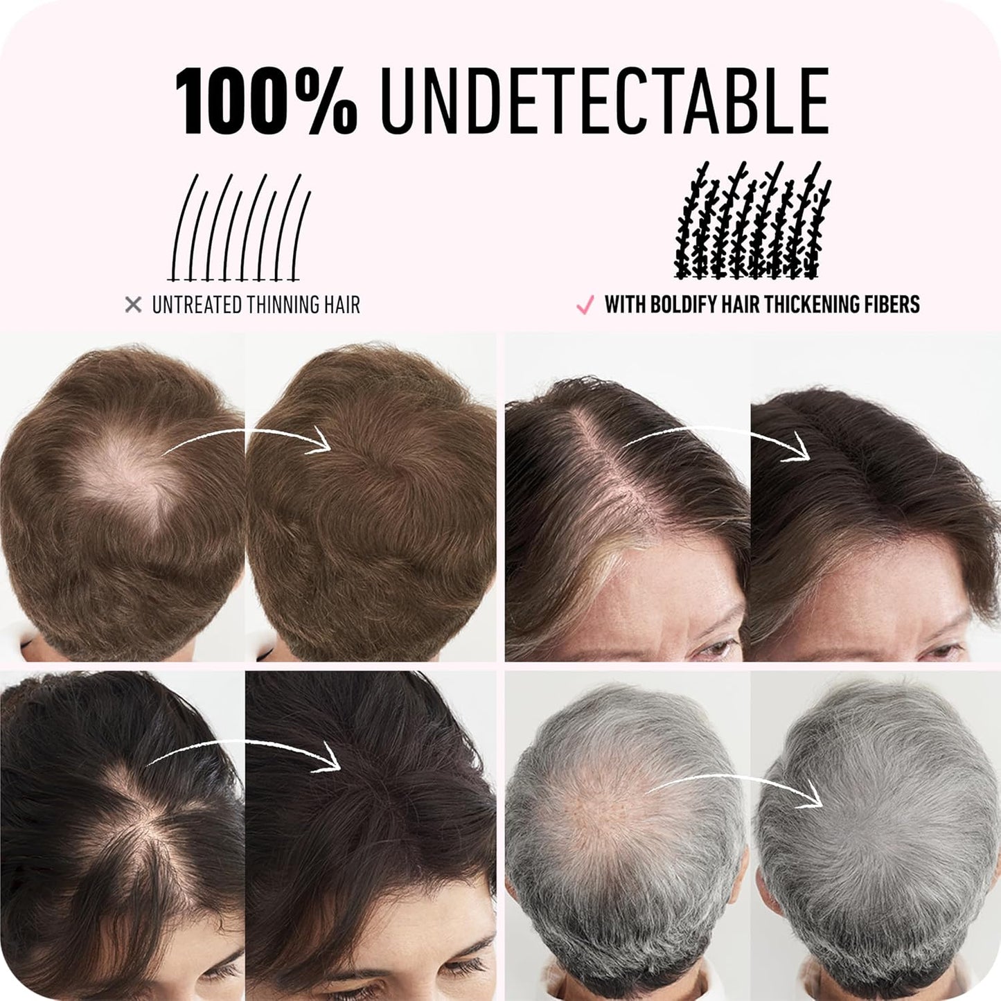 BOLDIFY Hair Fibers (56g) - Fill In Thinning and Fine Hair for an Instantly Fuller, Thicker Look - 14 Shades for Women & Men - Medium Brown