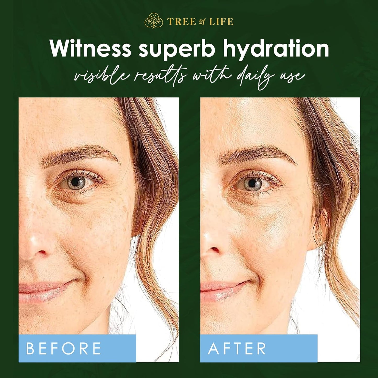 Tree of Life Beauty Hyaluronic Acid Serum, Skin Brightening Face Oil for Dark and Age Spots, Facial Serums for Dry and Sensitive Skin Care with Vitamin E for Soft Smooth Skin, 2 Fl Oz, (Pack of 2)