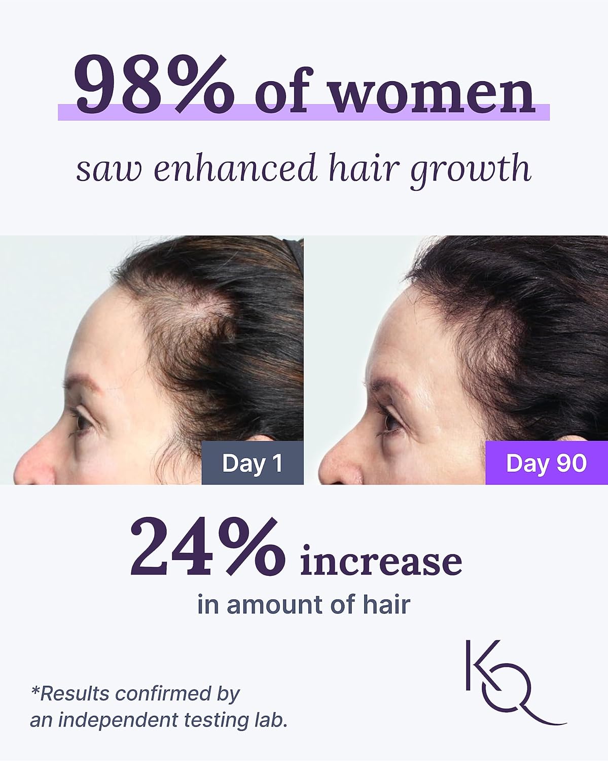 Keranique KeraViatin Hair & Scalp Health Supplement, Clinical Strength, Biotin, Vitamin B, 120 Softgels-60 Count (Pack of 2)