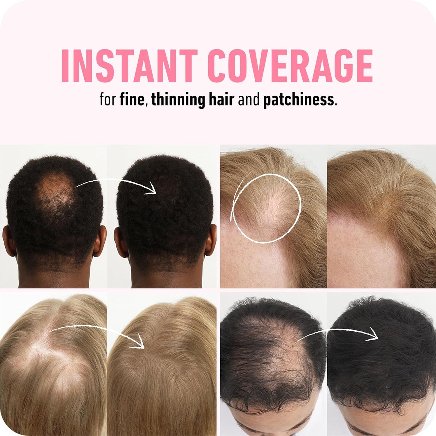 BOLDIFY Hair Fibers (28.5g) - Fill In Thinning and Fine Hair for an Instantly Fuller, Thicker Look - 14 Shades for Women & Men - Light Blonde