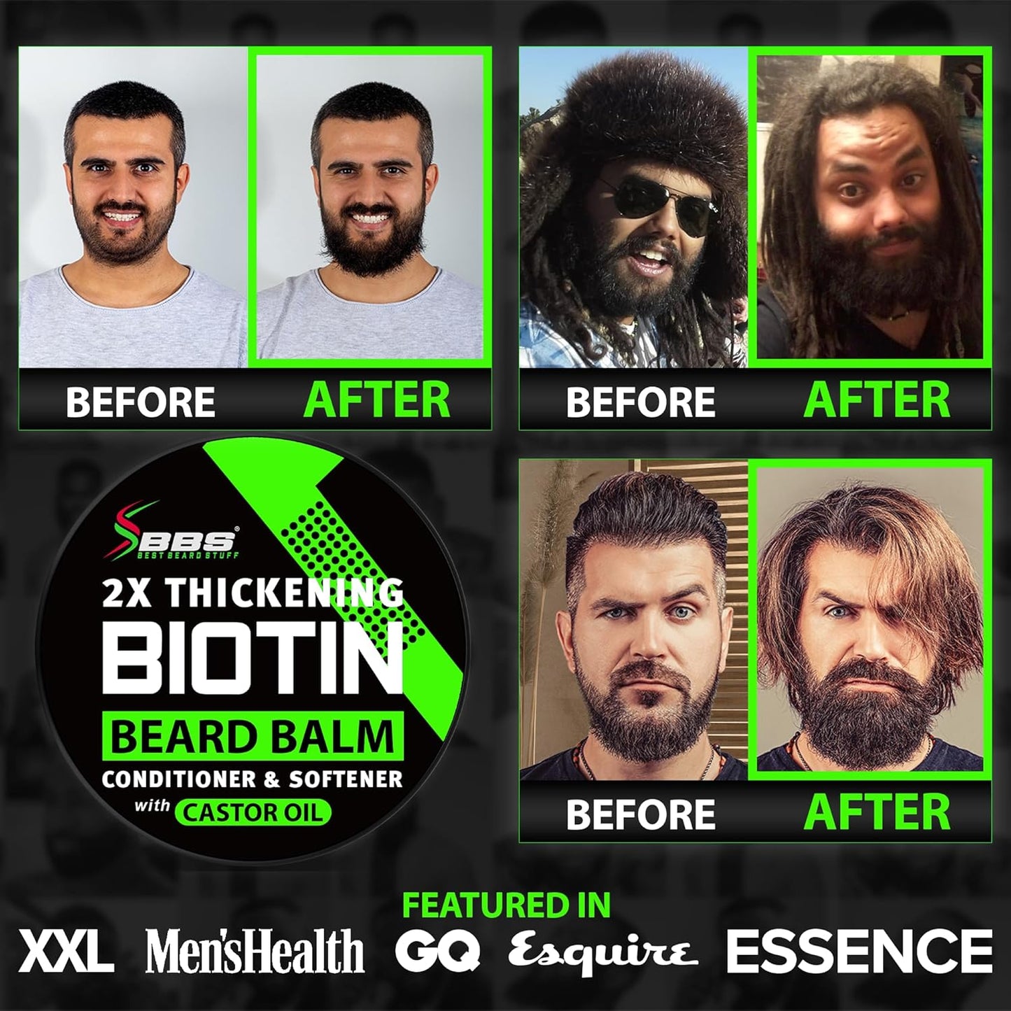 Beard Growth Kit w/ 2X Thickening Biotin Beard Balm/Beard Care & Beard Conditioner + 6X Liquid Biotin with Collagen Peptides for Beard & Hair Growth