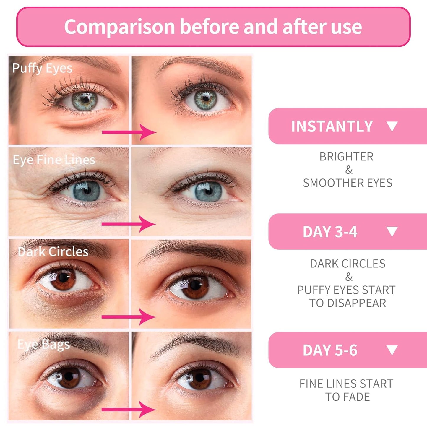 BREYLEE Pink Rose Eye Mask– 30 Pairs - Under Eye Mask Amino Acid & Collagen, Under Eye Mask for Face Care, Eye Masks for Dark Circles and Puffiness, Under Eye Masks for Beauty & Personal Care