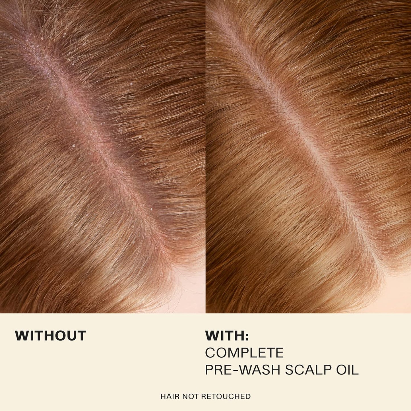 JVN Pre-Wash Scalp Oil & Hair Treatment Oil, Pre Shampoo Dry Scalp Treatment, Scalp Cleansing Oil for All Hair Types, Sulfate Free (1.7 Fl Oz)